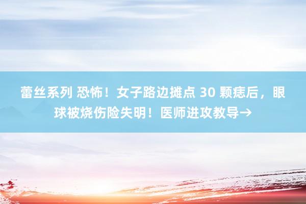 蕾丝系列 恐怖！女子路边摊点 30 颗痣后，眼球被烧伤险失明！医师进攻教导→